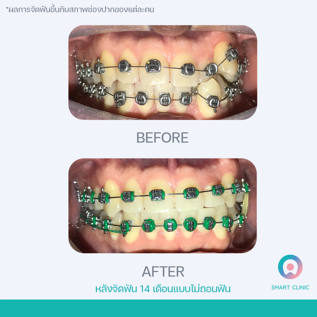 329196474_614174513870523_8565450344910389697_n